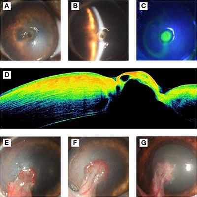 Case Report: The First Report on Moraxella canis Isolation From Corneal Ulcer in a Bulldog